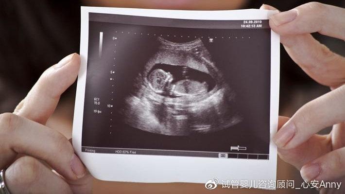 泰国试管婴儿自助攻略